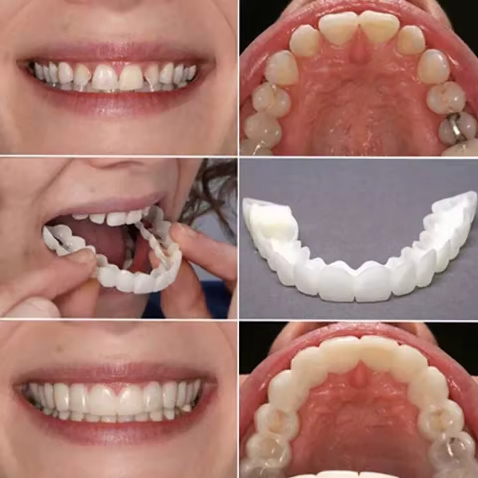 Sonrisa Perfecta al Instante - Carillas Dentales Removibles